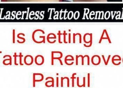 Tattoo Removal By Laser – Are You Certain This Is The Method You Need To Use?