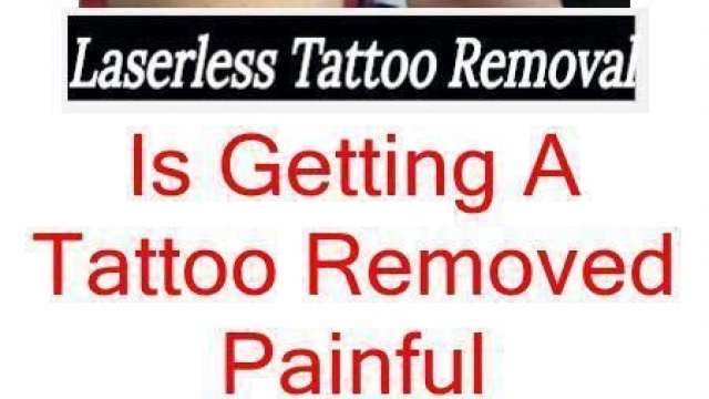 Tattoo Removal By Laser – Are You Certain This Is The Method You Need To Use?