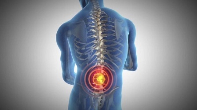 Banishing the Backache: Effective Pain Management for Low Back Pain