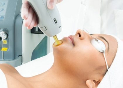 Smooth Skin Secrets: The Magic of Laser Hair Removal