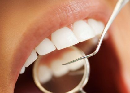 Sparkling Smiles: The Ultimate Guide to Dental Services